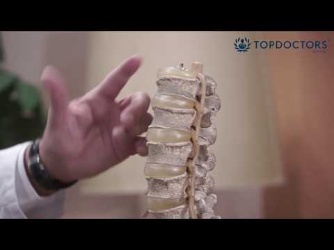 Microdiscectomía: cirugía para la hernia de disco lumbar