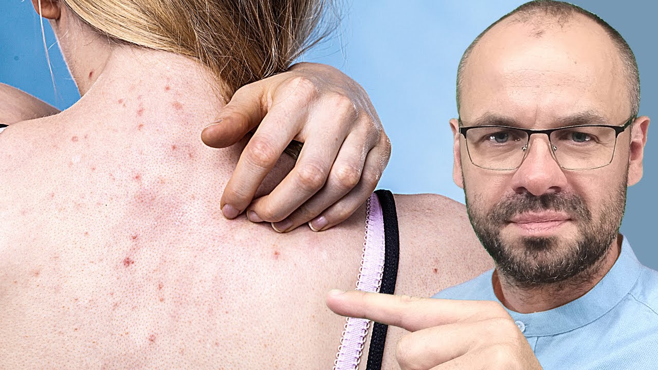 15 wczesnych objawów chorej WĄTROBY ⚠️