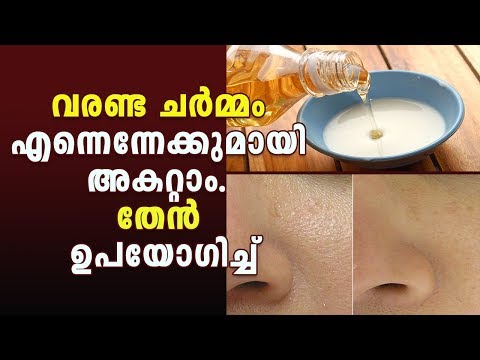 വരണ്ട ചർമ്മം എന്നെന്നേക്കുമായി അകറ്റാം. തേൻ ഉപയോഗിച്ച്