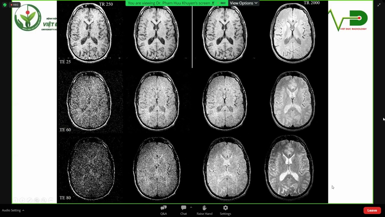 MRI | CÁC CHUỖI XUNG CƠ BẢN | BS. Phạm Hữu Khuyên