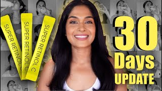 Retinol Supplement Review | 30 Day Honest Results