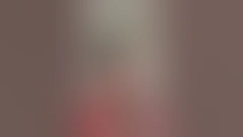 Severe Anorexia Nervosa: A Case Study