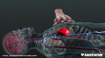 ¿Puede funcionar la reanimación cardiopulmonar después de la muerte?