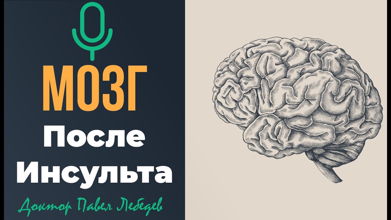 Подкаст. Мозг после инсульта — как он восстанавливается и что помогает