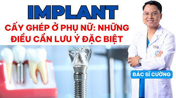 Cấy ghép Implant ở phụ nữ: Những điều cần lưu ý đặc biệt | Dr Cường Official