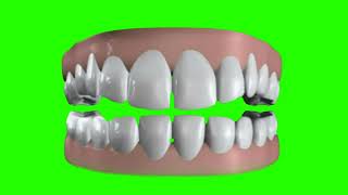Dentures Clicking Teeth On Green Screen Teeth Clicking Sound