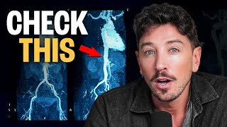 Doctors Predict My Heart Risk: What They Found in My CT Angiogram | The Proof Clips EP #372
