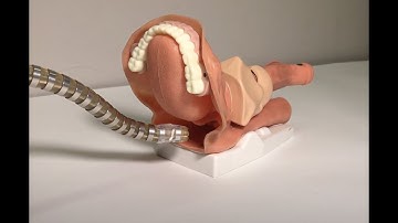 Deep Q Reinforcement Learning for Autonomous Navigation of Surgical Snake Robot in Confined Spaces