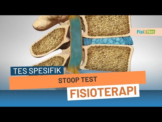 Stoop Test - Klaudikasio Intermiten Neurogenik class=