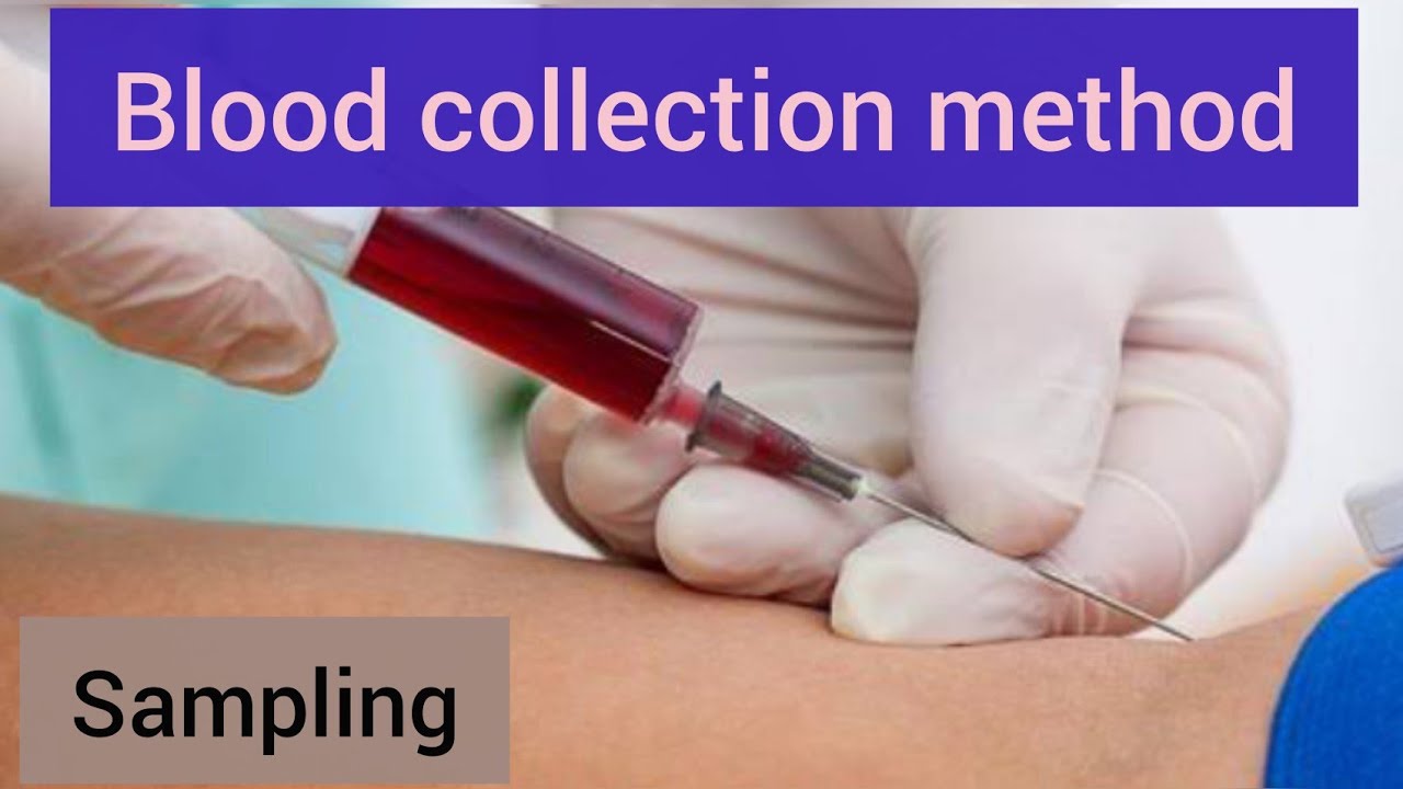 Blood sample collection phlebotomy. venipuncture easiest way to