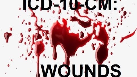 ICD-10-CM: Wounds and Other Injuries