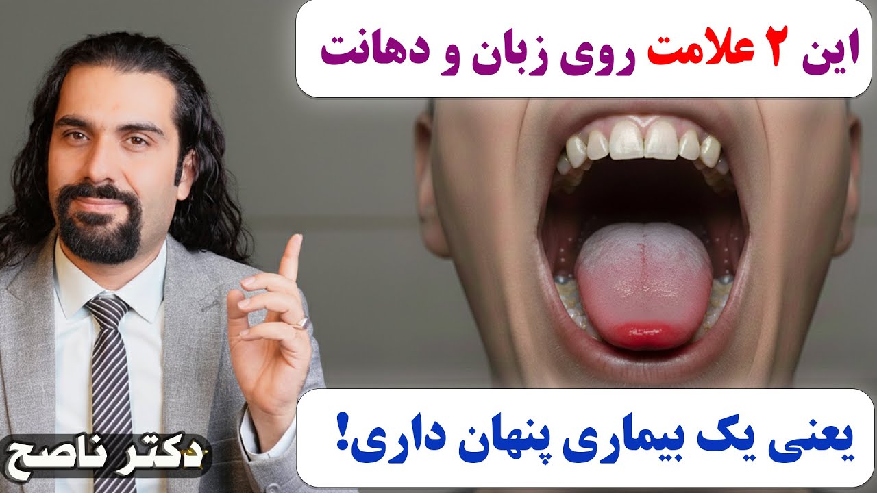 این دوعلامت روی زبان و دهانت یعنی یک بیماری پنهان داری! ناگفته های دهان و دندان  با دکتر ناصح
