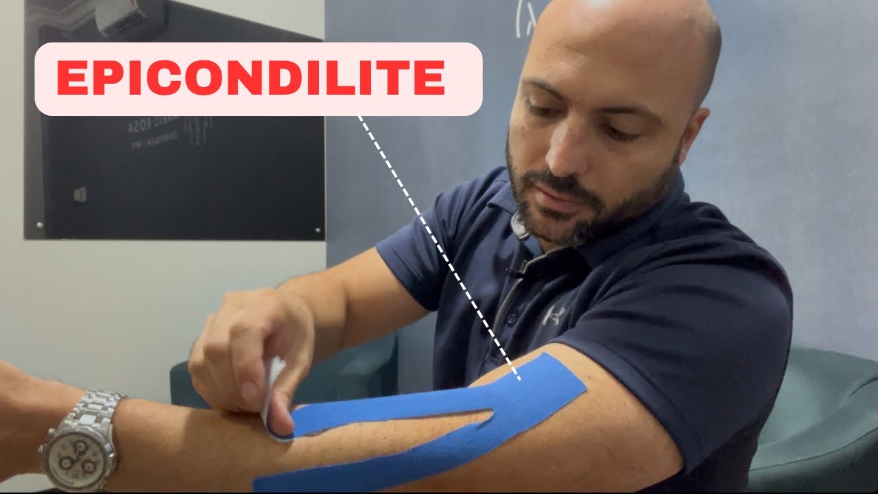 BANDAGEM E EXERCÍCIO PARA TIRAR A DOR DA EPICONDILITE