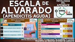 ESCALA DE ALVARADO PARA APENDICITIS | GuiaMed