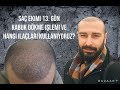 SAÇ EKİMİ 13. GÜN KABUK DÖKME NASIL YAPILIR? - VİDEO 3