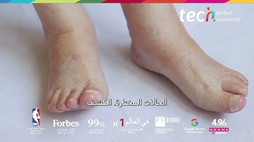 النهج السريري للوذمة اللمفية في الطب التجميلي ❘ TECH Global University