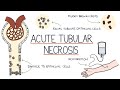 Understanding Acute Tubular Necrosis