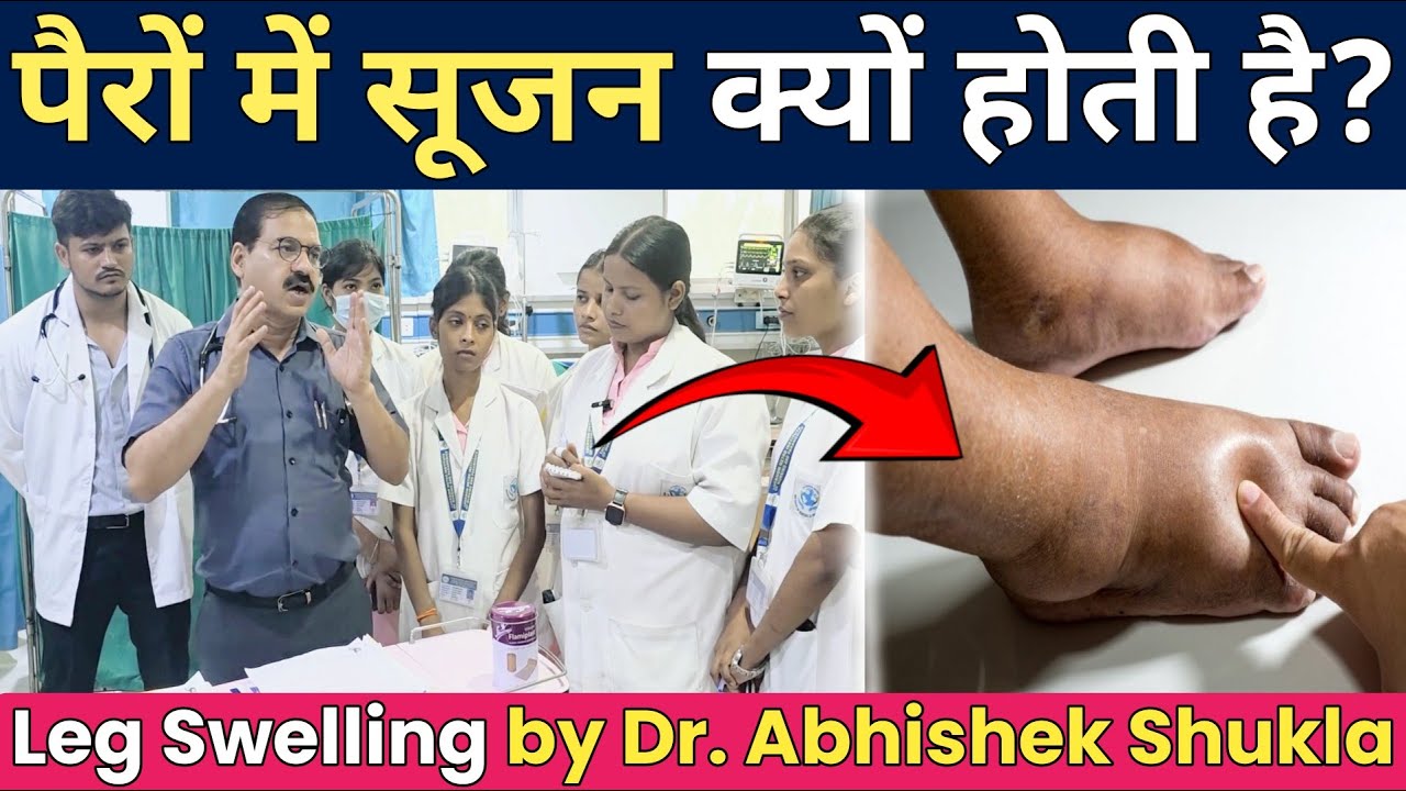 Leg Swelling (Edema) के मुख्य कारण | pairo me sujan kyu aati hai | pairo me sujan ka ilaj