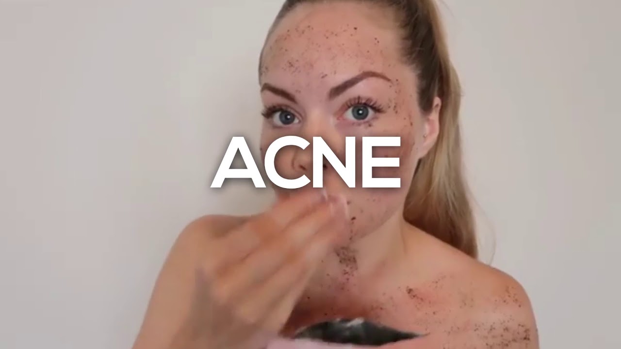 Say Goodbye to Stretch marks