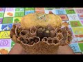 Incredible!!! Cute Girl Satisfying Hundred Worms In Nest On Poor Boy's Head #778