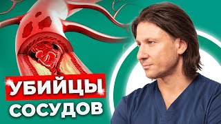 ЭТИ ПРОДУКТЫ ВАС УБ*ЮТ! / Что забивает наши сосуды и как от этого избавиться?