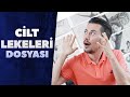 Cilt Lekeleri Dosyasını Açıyoruz! 🔍