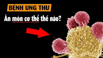 Tất cả về bệnh Ung thư trong 6 phút?