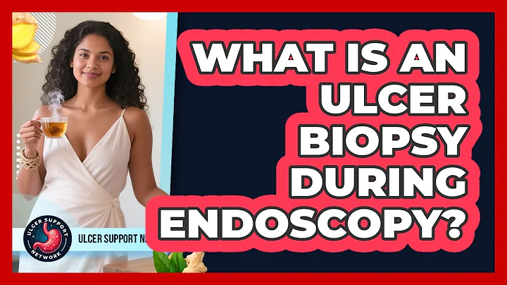 What Is an Ulcer Biopsy During Endoscopy?