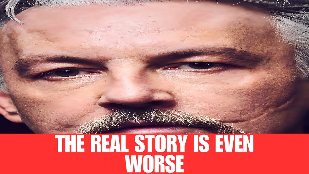 Tommy Flanagan Uncovers the Secrets Behind His Intriguing Scars! - YouTube