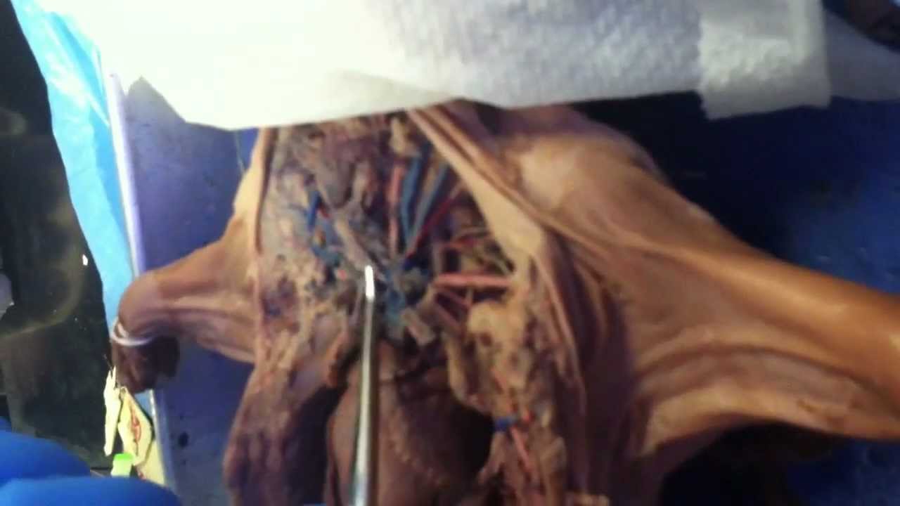 Fetal Pig Dissection - Circulatory System - YouTube