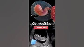 12 weeks baby movement #ultrasound #real #baby #movement