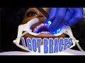 COME WITH ME TO GET BRACES VLOG |