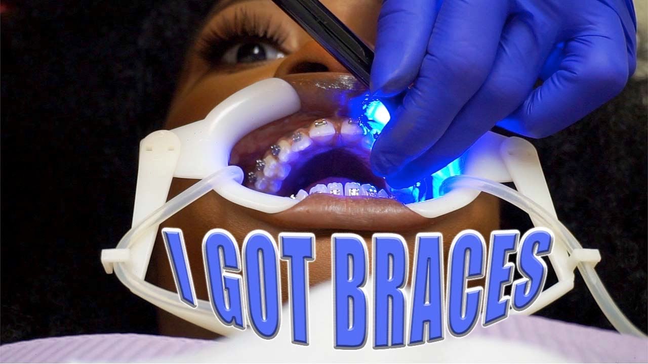 COME WITH ME TO GET BRACES VLOG |