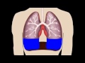 Shortness of breath  pleural fluid 10 min compilation