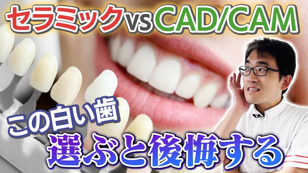 保険 適用 白い 歯 デメリット