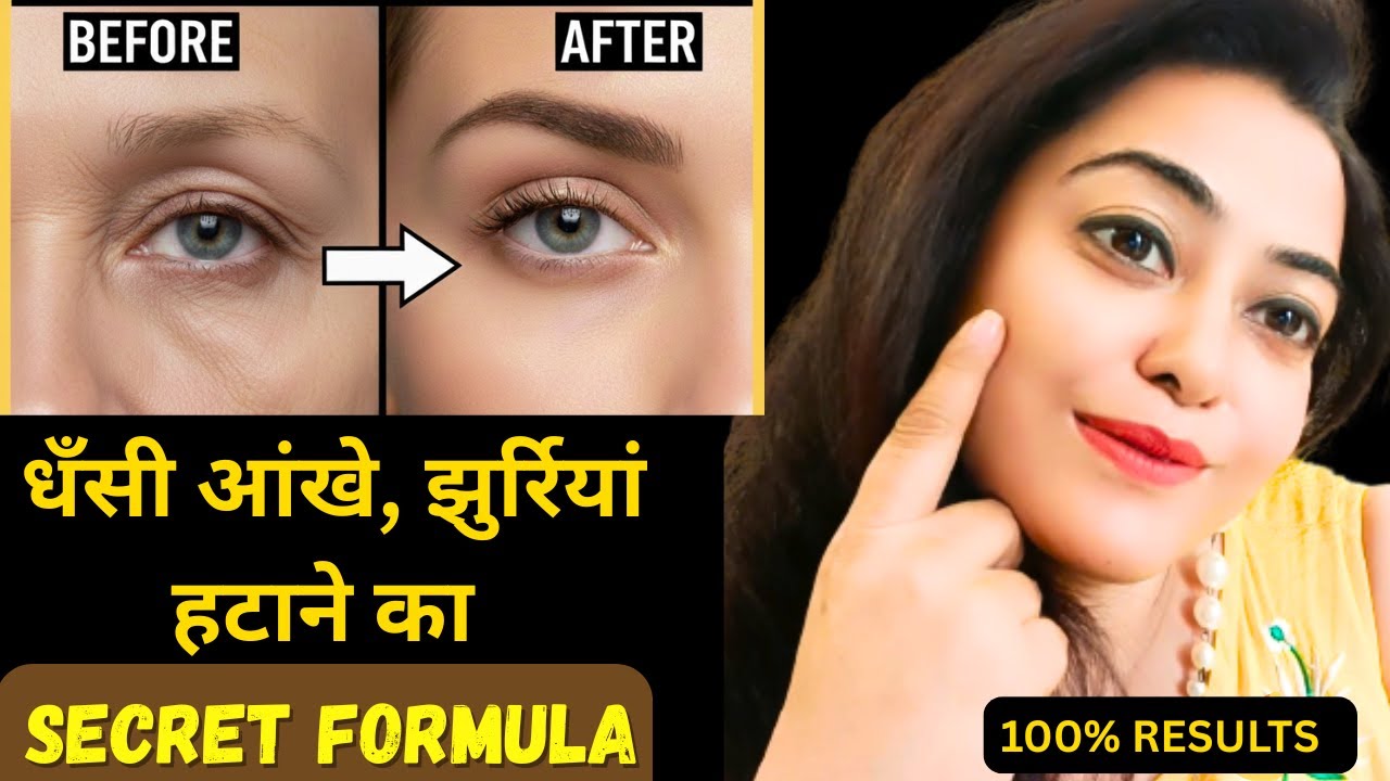 7 Days to Get Rid of SUNKEN EYES and Wrinkles at Home