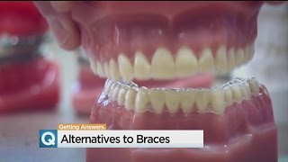 adults with crooked smiles looking for alternatives to braces
