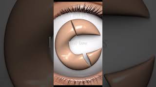 ASTIGMATISM: The Distorted Refraction #Astigmatism #RefractiveError #3DMedicalAnimation