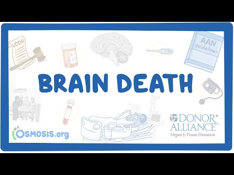Donor Alliance - Brain Death