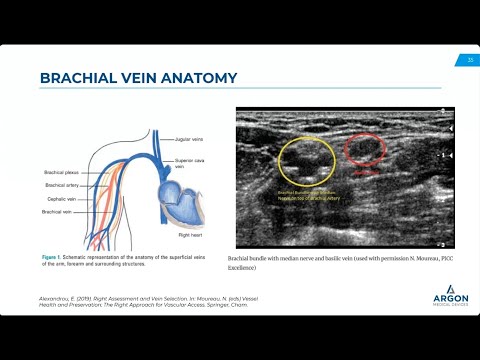 Cutting Edge Endomyocardial Biopsies EMB Tips Tricks From A High Volume Center 