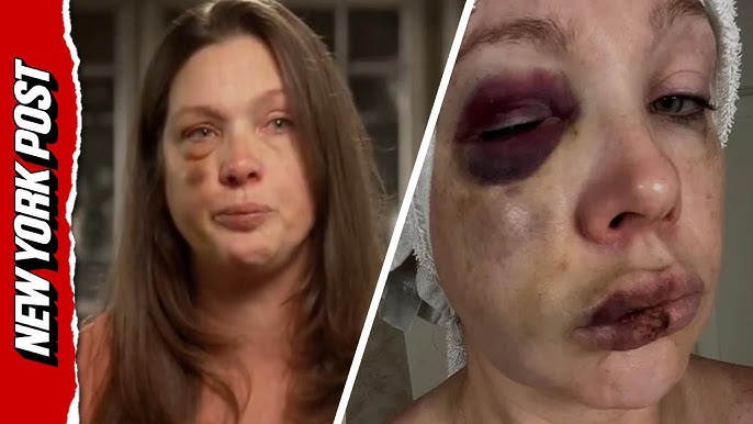 Single mom viciously beaten in Cincinnati brawl breaks down: 'I am not  okay' - YouTube