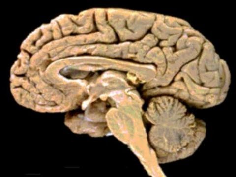 Vídeo: ¿Es El Cerebro Un Músculo, Un órgano O Una Grasa? Lo Que Necesitas Saber