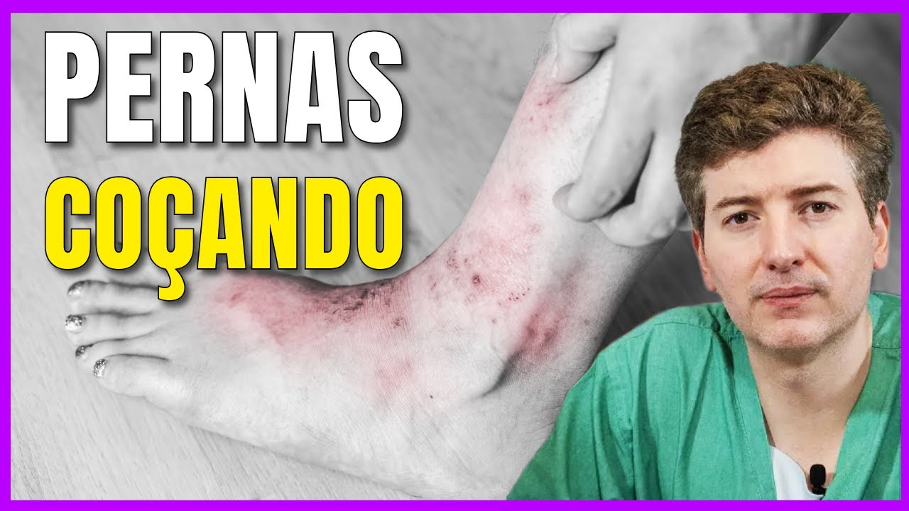 Coceira nas Pernas Após Correr? Descubra o Porquê e Soluções! - YouTube