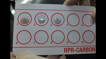 Rapid Plasma Reagin (RPR) Test