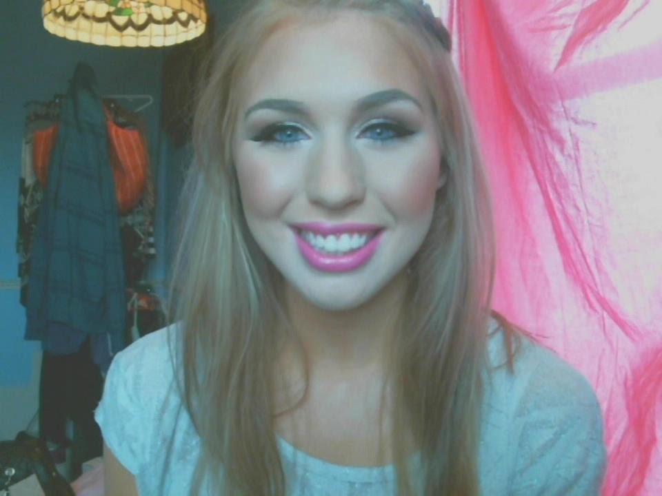 My Lip Injection Experience: Recovery