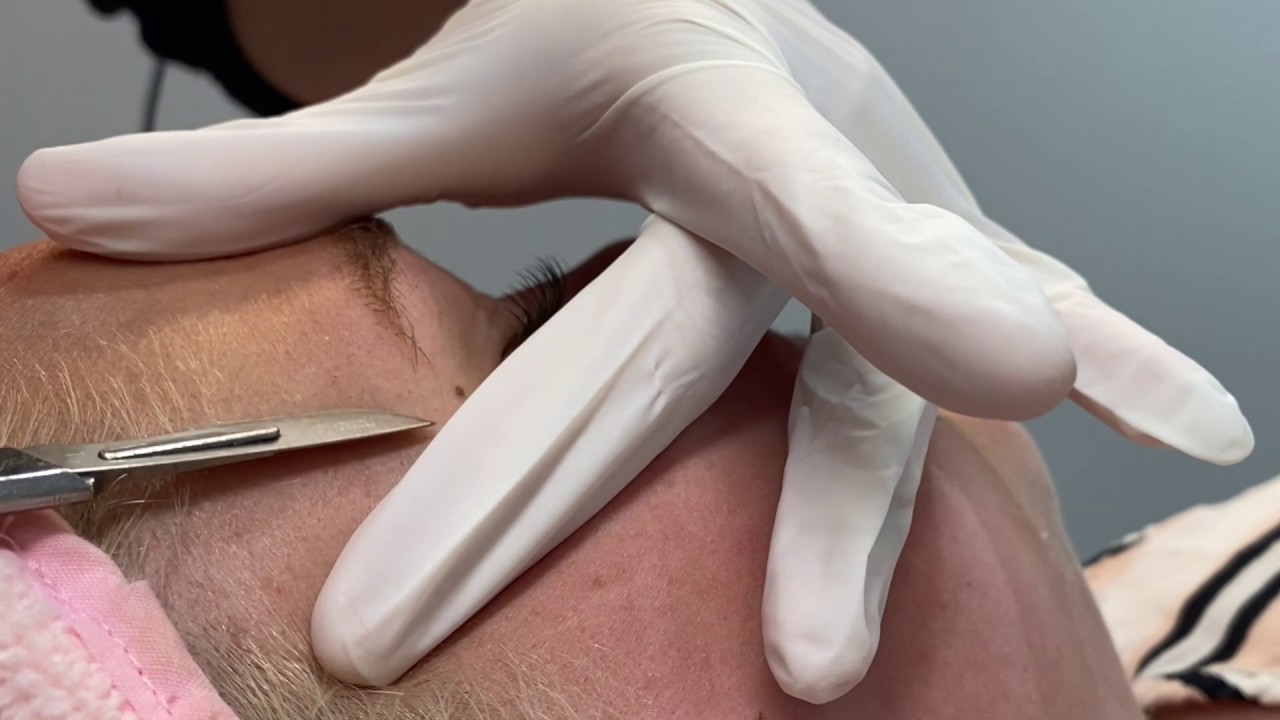 Satisfying Dermaplaning treatment