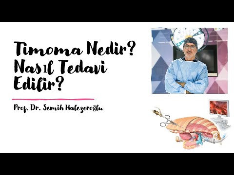 Timoma Nedir, Nasıl Tedavi Edilir?