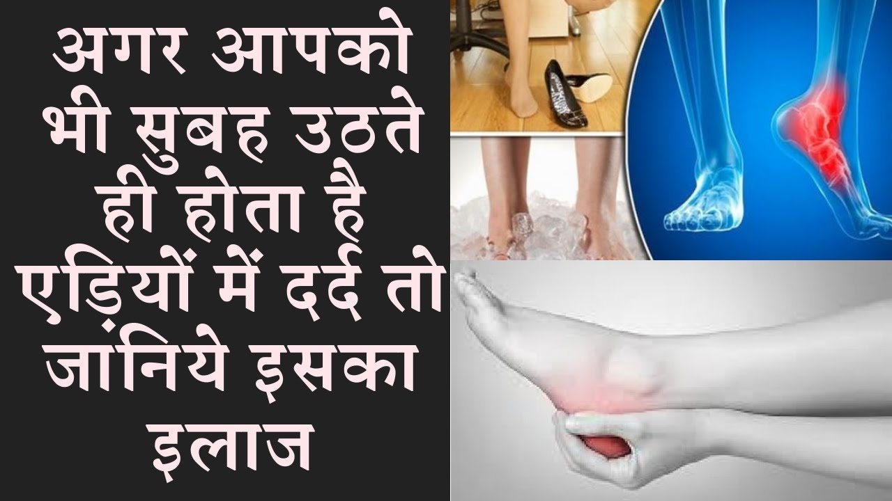 natural-home-remedies-for-heel-pain