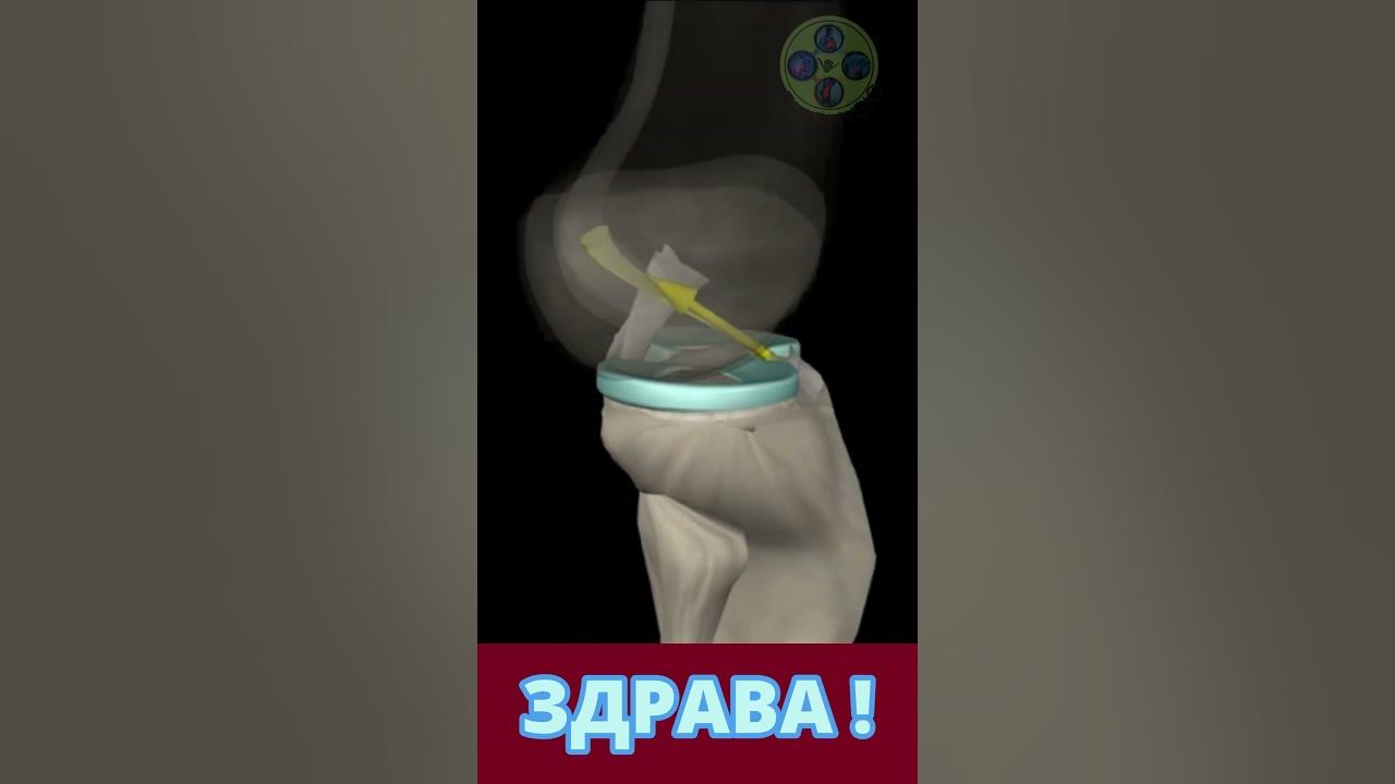 СКЪСАНИ ВРЪЗКИ НА КОЛЯНОТО! ТЕСТОВЕ! - YouTube