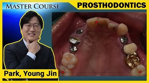 [Master Course Season2 -PROSTHODONTICS] Bite Registration